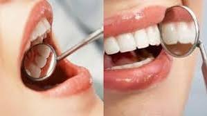 मसूड़ों से खून आना दिल की बीमारी का संकेत है, क्या आप जानते हैं कि इन दोनों के बीच क्या है कनेक्श