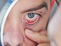 ये लक्षण हो सकते हैं आंखों के कैंसर के शुरुआती संकेत, इन्हें नजरअंदाज करने की गलती न करें