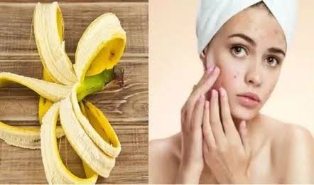 केले के छिलके आप अपने चहरे को चमकदार बना सकते हैं, जानिए कैसे करें इस्तेमाल