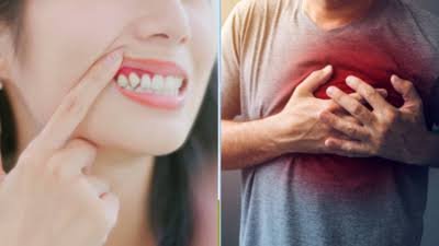 मसूड़ों से खून आना दिल की बीमारी का संकेत है, क्या आप जानते हैं कि इन दोनों के बीच क्या है कनेक्श