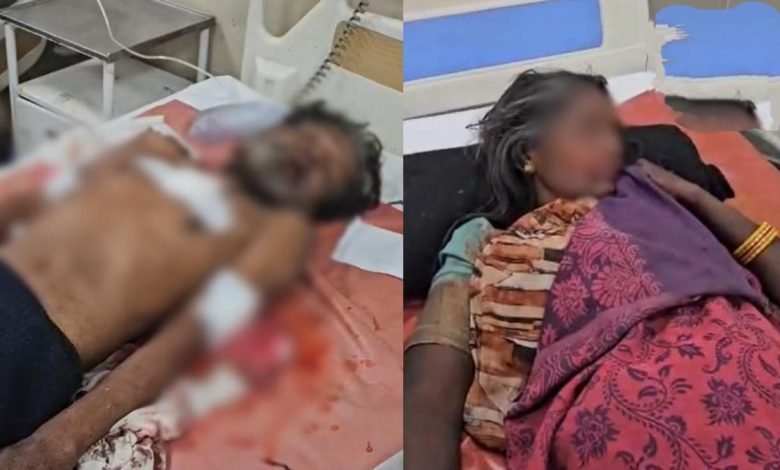 CG: पैसे के विवाद में पति बना दरिंदा, पत्नी पर चाकू से हमला, दोनों ICU में भर्ती