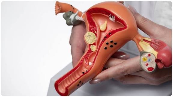 पुरुषों की ये तीन आदतें महिलाओं में बढ़ाती हैं सर्वाइकल कैंसर का खतरा, जानें क्यों है यह इतनी खतरनाक बीमारी