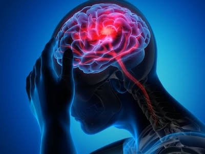 कब फट जाती है इंसान के दिमाग की नस, इन 12 शुरुआती संकेतों को न करें नजरअंदाज, वरना जा सकती है जान