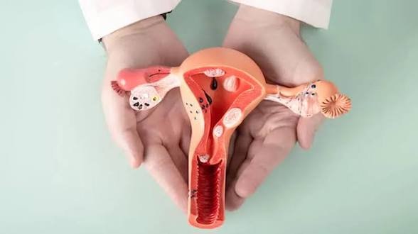 सिर्फ पीरियड्स से जुड़ी समस्या नहीं है PCOS, इसका मेंटल और इमोशनल हेल्थ पर भी पड़ता है गहरा प्रभाव